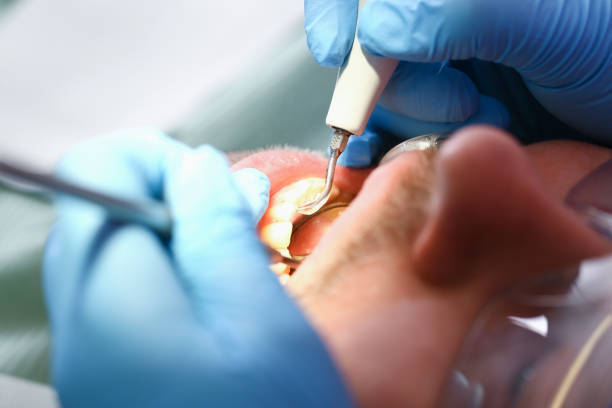 Best Walk-In Emergency Dentist in Johnson, AR
