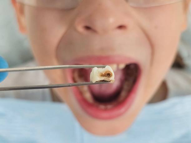 Best Same-Day Emergency Dentist in Johnson, AR